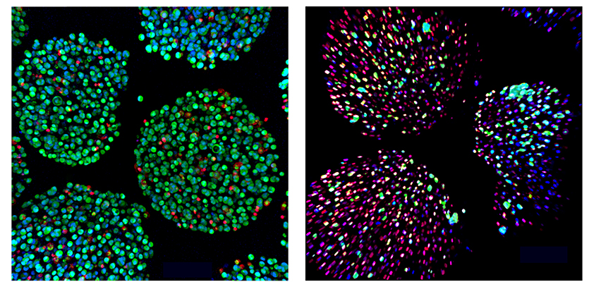 A side-by-side comparison of cells supported by the oxygenation device (left) and cells without the device (right). Dead cells shown in red; living cells in green.
