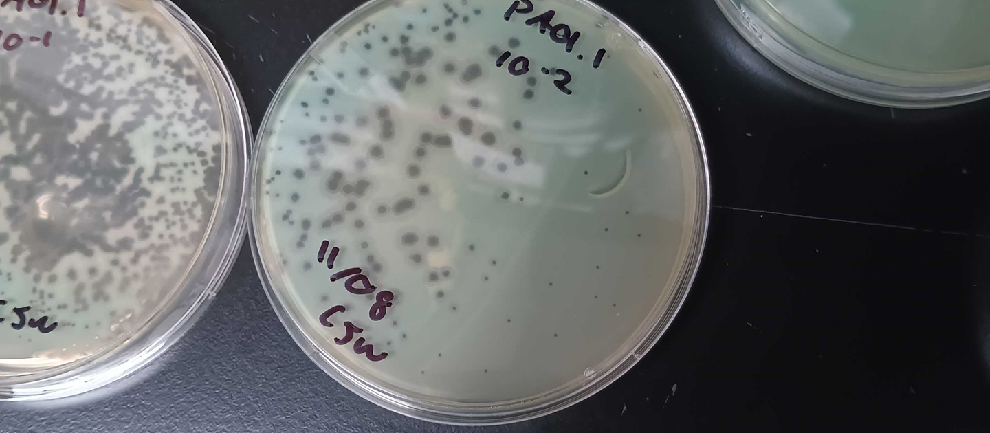 The dark spots in the dishes mark areas where the viruses burst out of the bacteria, effectively killing them. Credit: Cole Wilson