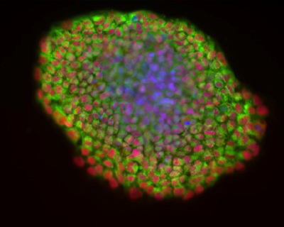 Credit: Induced pluripotent stem cells (Bin Jiang)