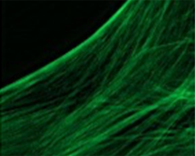 Credit: Stress fibers in a Schlemm's canal endothelial cell (Mark Johnson)