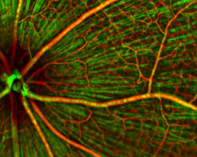 Credit: Visible-light OCT fibrography for quantitative imaging of retinal ganglion axon bundles (Hao Zhang)
