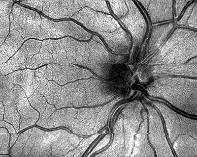 Credit: Ophthalmic imaging (Hao Zhang)