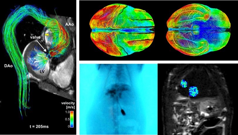  Brain imaging