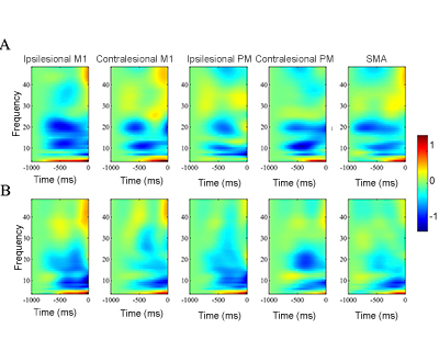Credit: Averaged Time-Frequency plot for each source in the motor network for Hand Opening (Jun Yao and Julius Dewald)