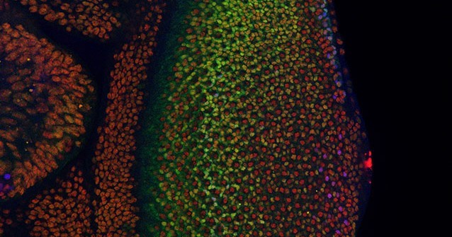 Researchers Pinpoint Place Where Cancer Cells May Begin (Amaral)