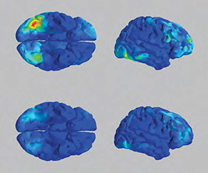 EEG and fMRI signals