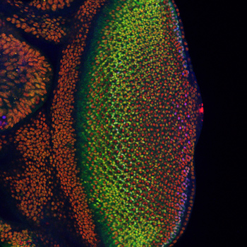 The fruit fly’s eye is an intricate pattern of many different specialized cells, and scientists use it as a workhorse to study what goes wrong in human cancer. In a new study of the fly’s eye, Northwestern University researchers have gained insight into how developing cells normally switch to a restricted, or specialized, state and how that process might go wrong in cancer. (Credit: Northwestern University)