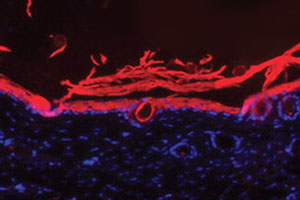 An immunofluorescence image shows regenerated dermal tissue (in pink) in wounds treated with Ameer's bandage.
