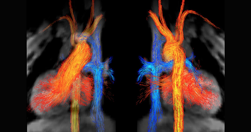 First place: Kelly Jarvis, "Blood Flow through the Heart"