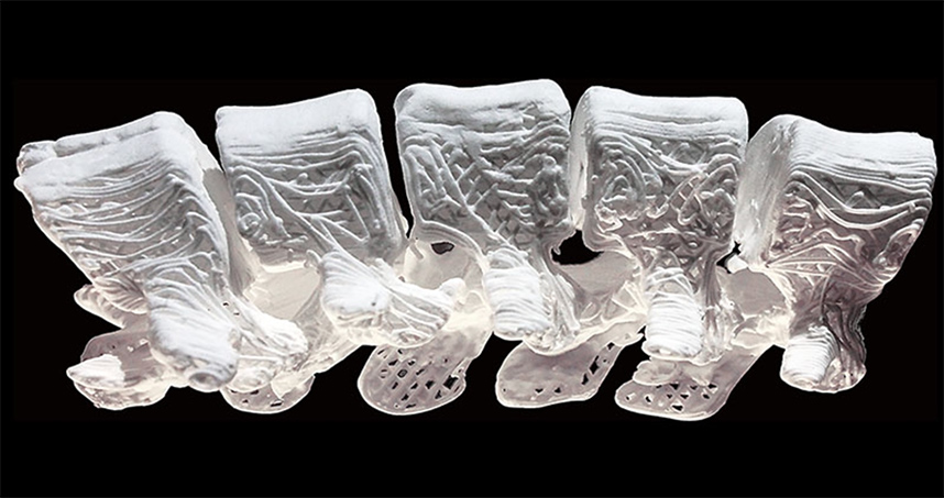 Second Place: Adam Jakus, "3D Printed Bone"