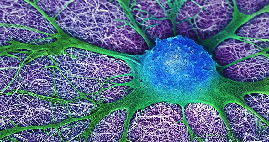 Fifth Place: Mark McClendon, "Neural Cell Looking for Friends"