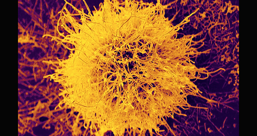 Honorable Mention: Christopher Serrano, "Magnetic Burst"