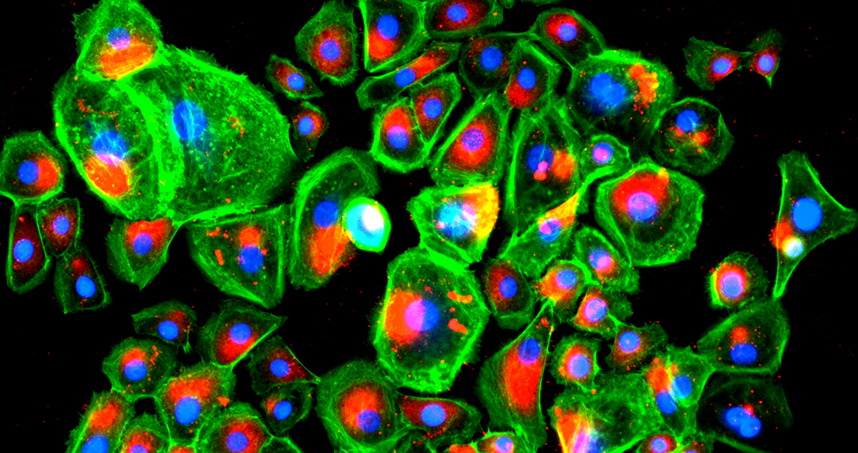 Stained epidermis cells cultured on the A5G81 peptide. (Credit: Ameer Research Lab, Northwestern University)