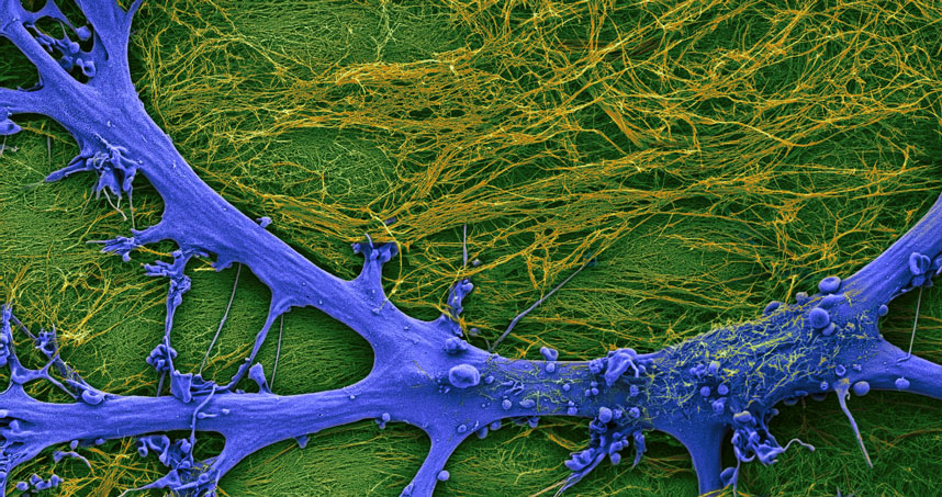 Reactive phenotype of brain astrocyte triggered by superstructures contact. Credit Mark McClendon, Zaida Alvarez