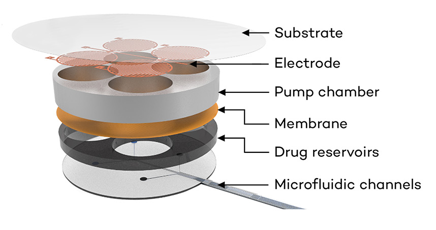 The closed-loop drug-delivery system, which senses dangerously low oxygen levels, delivers naloxone.