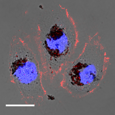 Human cells treated with selenomelanin nanoparticles