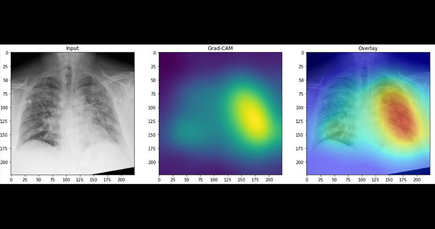 Generated heat maps highlighted abnormalities in the lung fields in images accurately labeled as COVID-19 positive.