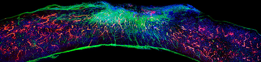 Depicted here is a longitudinal spinal cord section treated with the most bioactive therapeutic scaffold, captured 12 weeks after injury. Blood vessels (red) regenerated within the lesion. Laminin is stained in green and cells are stained in blue.