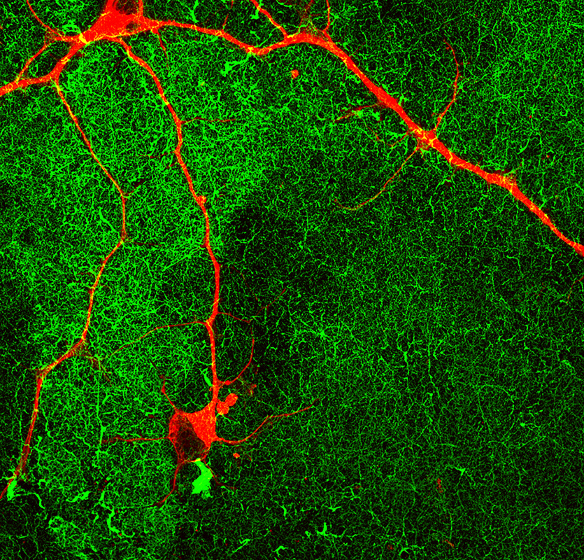 This is a fluorescent image of a human neuron (red) growing on the coating with fast-moving molecules (green) for 60 days.