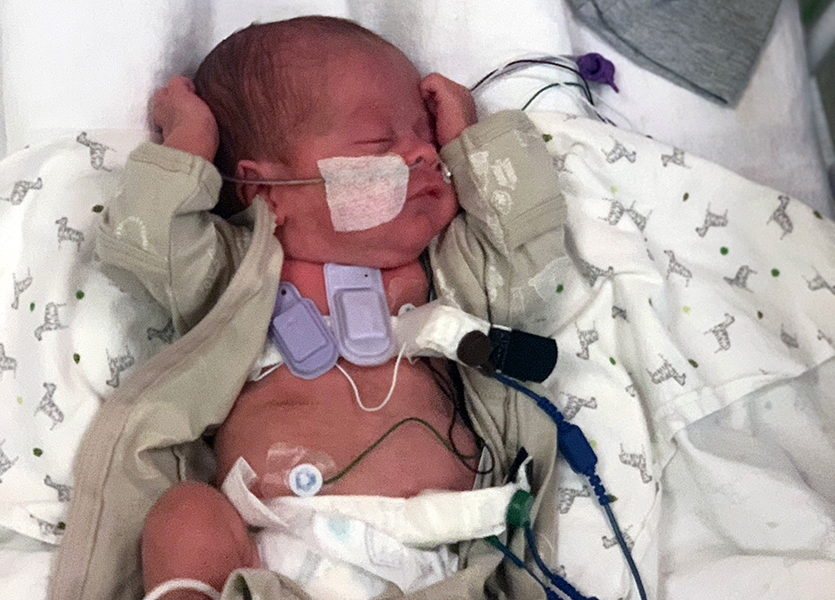 Wearable devices capture sounds inside a premature baby's lungs. Credit: Montreal Children's Hospital