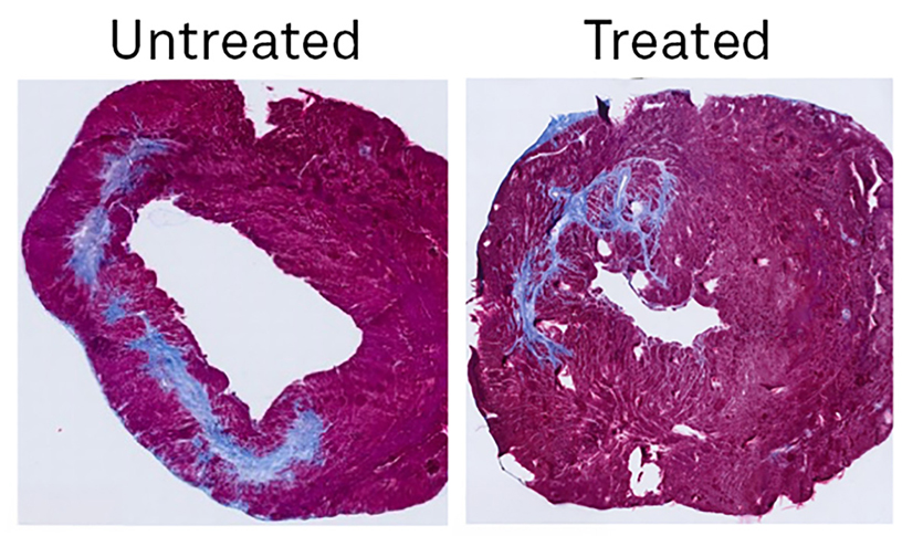 The sample on the right, which was treated with the PLP therapy, shows decreased scarring (in blue) compared to the untreated sample on the left.