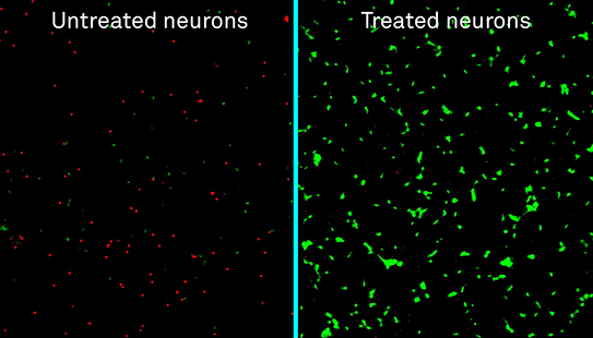 Labeled micrographs of human neurons exposed to amyloid-beta proteins and either left untreated (left) or treated with the new nanotherapy developed at Northwestern (right). Dead neurons are stained in red; live neurons are green.
