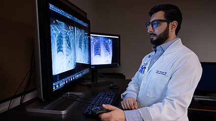 New AI Transforms Radiology with Speed, Accuracy Never Seen Before