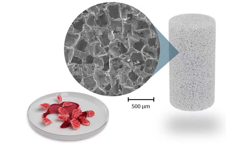 Citregraft is a highly porous, citrate-based polymer and bioactive glass bone-graft substitute that can be shaped to irregular defects, binds growth factors, releases citrate to promote regeneration, and ultimately resorbs as it is replaced by natural bone.