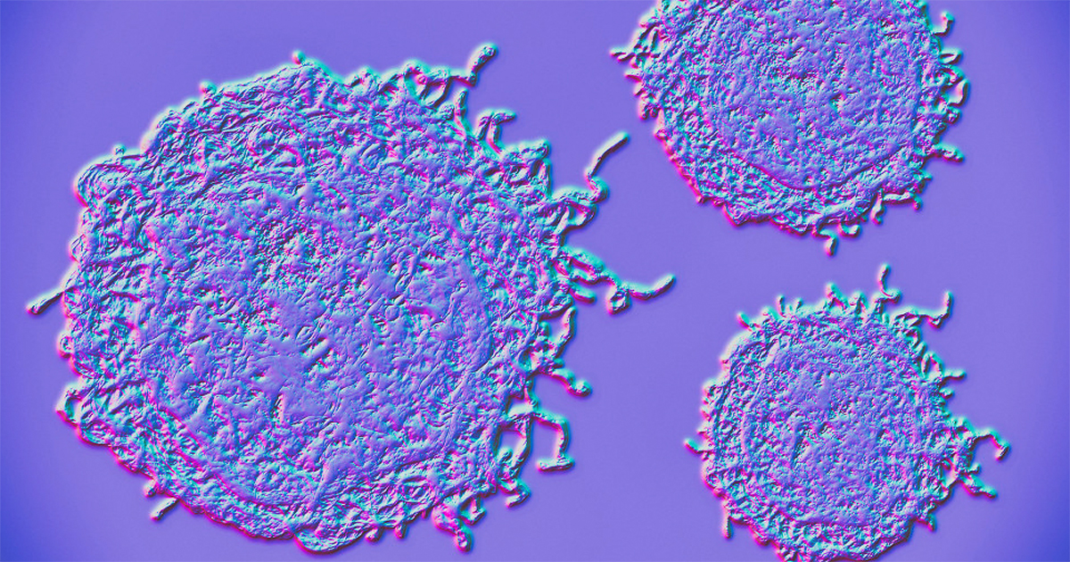 Northwestern scientists developed a protein-like polymers (PLPs) capable of grabbing proteins and directing them to the cell’s waste-disposal machinery. From there, the proteins are degraded and disposed, triggering cancer cell death. 