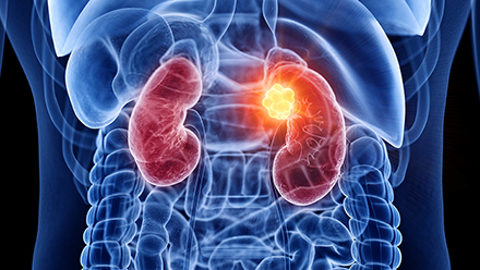 Kidney
