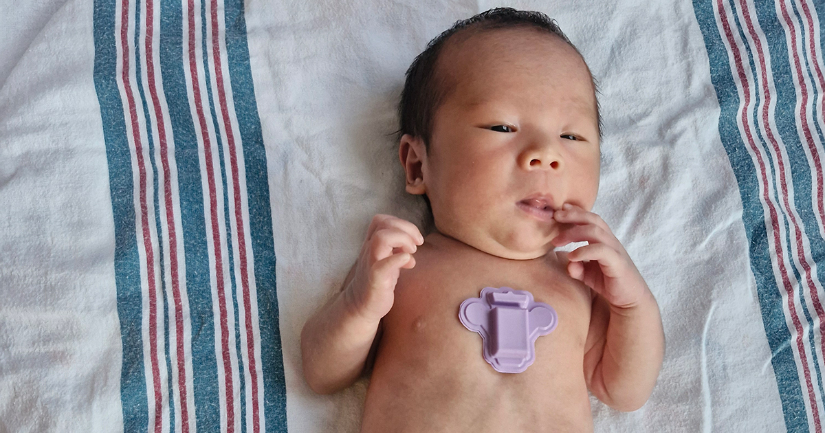 By continuously monitoring physiological signs of stress, the device can detect underlying stress in individuals, including babies, who cannot communicate.