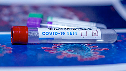 COVID Diagnostics