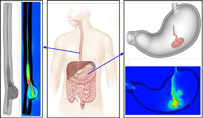 Biomechanics of the upper GI (N. Patankar, S. Halder, S. Acharya; 