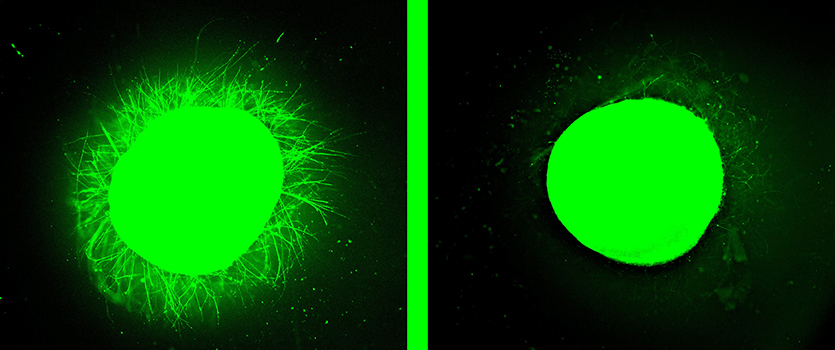 Fluorescent micrographs showing increased neurite outgrowth from a human spinal cord organoid treated with fast-moving “dancing molecules” (left) compared to one treated with slow-moving molecules (right) containing the same bioactive signals.