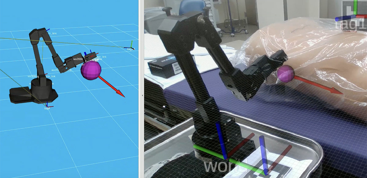 A Robot-Assisted Solution for Spinal Surgery | Inside Our Program ...